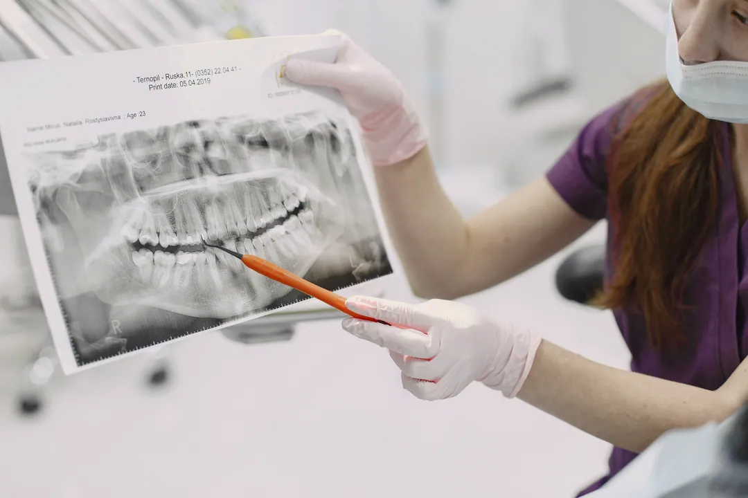 Explaining a panoramic X-ray, pencil in hand