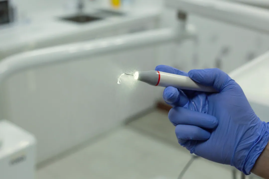 A gloved hand holds a lit curing light over the chair
