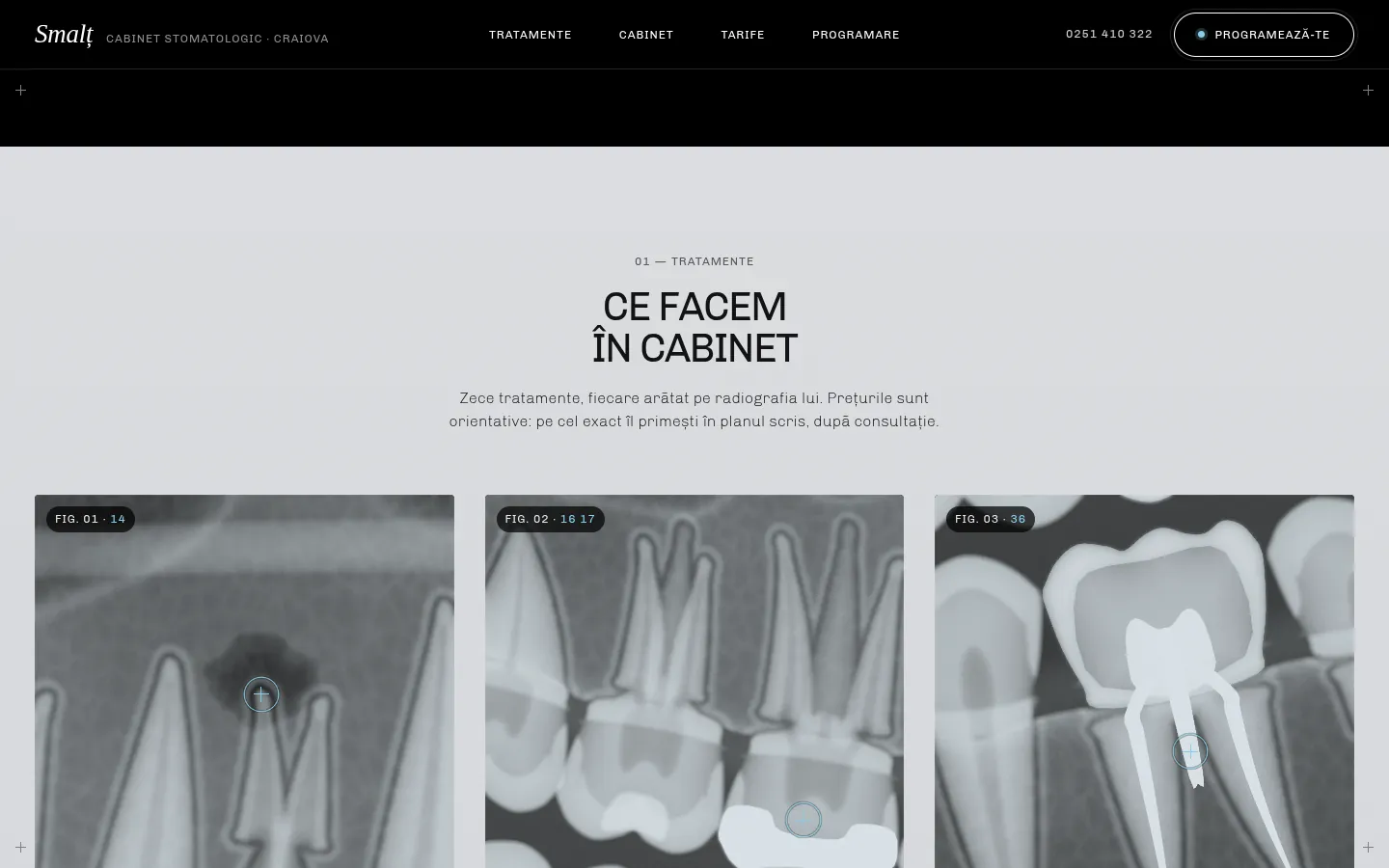 SMALȚ: a screen further down the page